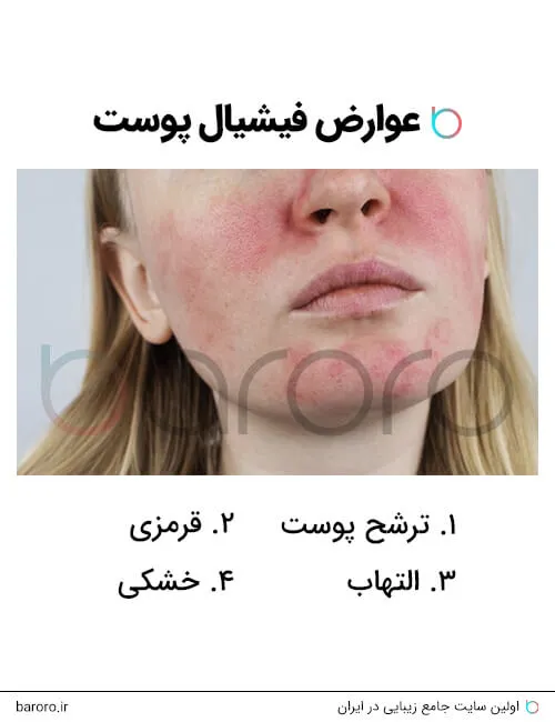 عوارض فیشیال پوست